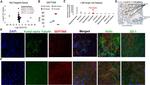 Acetyl-alpha Tubulin (Lys40) Antibody in Immunocytochemistry (ICC/IF)