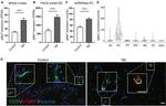 CD31 Antibody in Immunohistochemistry (IHC)