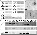 TSG101 Antibody in Western Blot (WB)