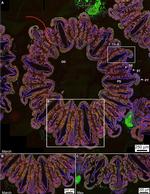 Calmodulin Antibody in Immunohistochemistry (IHC)