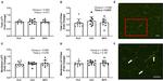 Dystrophin Antibody in Immunohistochemistry (IHC)