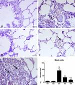 c-Kit Antibody in Immunohistochemistry (IHC)