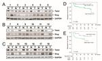 SLUG Antibody in Western Blot (WB)