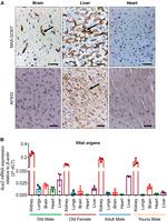 ACE2 Antibody in Immunohistochemistry (IHC)