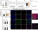 IBA1 Antibody in Immunohistochemistry (IHC)