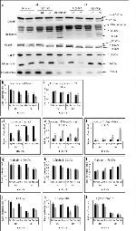 Mu-Calpain Antibody in Western Blot (WB)