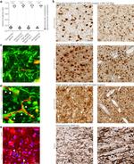 CD31 Antibody in Immunohistochemistry (IHC)