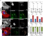 gamma Tubulin Antibody in Immunocytochemistry (ICC/IF)