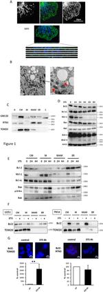 GM130 Antibody in Western Blot (WB)