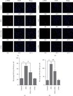 Phospho-IRE1 alpha (Ser724) Antibody in Immunocytochemistry (ICC/IF)