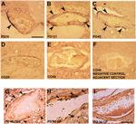 alpha Synuclein Antibody in Immunohistochemistry (IHC)