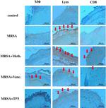 CD8a Antibody in Immunohistochemistry (IHC)