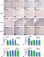 CD20 Antibody in Immunohistochemistry (IHC)