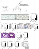 VEGF Receptor 3 Antibody in Immunohistochemistry (IHC)