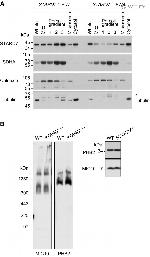 SDHA Antibody in Western Blot (WB)