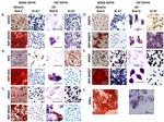 CD36 Antibody in Immunohistochemistry (IHC)