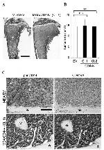 CD44 Antibody in Immunohistochemistry (IHC)