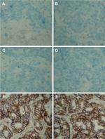 CD44 Antibody in Immunohistochemistry (IHC)