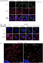 PMP70 Antibody in Immunocytochemistry (ICC/IF)