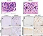 CD45 Antibody in Immunohistochemistry (IHC)