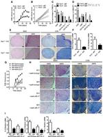 IL-17A Antibody in Neutralization (Neu)