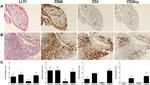 CD68 Antibody in Immunohistochemistry (IHC)