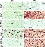 CD80 (B7-1) Antibody in Immunohistochemistry (IHC)