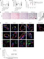 Angiopoietin 2 Antibody in Immunohistochemistry (IHC)