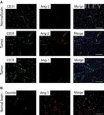 Angiopoietin 2 Antibody in Immunohistochemistry (IHC)