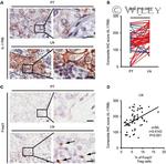 FOXP3 Antibody in Immunohistochemistry (Paraffin) (IHC (P))