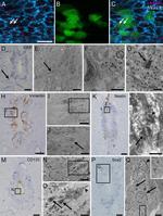 CD133 (Prominin-1) Antibody in Immunohistochemistry (IHC)