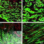 CD140a (PDGFRA) Antibody in Immunohistochemistry (IHC)