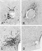 MHC Class II (I-A/I-E) Antibody in Immunohistochemistry (IHC)