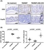 FOXP3 Antibody in Immunohistochemistry (IHC)