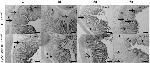 FOXP3 Antibody in Immunohistochemistry (IHC)