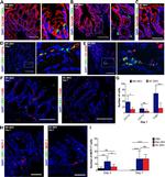 CD326 (EpCAM) Antibody in Immunohistochemistry (IHC)