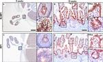 Blimp-1 Antibody in Immunohistochemistry (IHC)