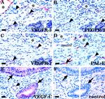 VEGF Receptor 3 Antibody in Immunohistochemistry (IHC)