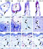 VEGF Receptor 3 Antibody in Immunohistochemistry (IHC)