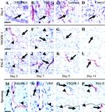 VEGF Receptor 3 Antibody in Immunohistochemistry (IHC)