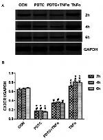 CX3CR1 Antibody in Western Blot (WB)