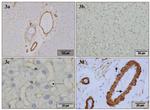 Actin (muscle) Antibody in Immunohistochemistry (IHC)