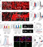 Myosin 4 Antibody in Immunocytochemistry (ICC/IF)