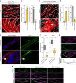 Myosin 4 Antibody in Immunocytochemistry (ICC/IF)