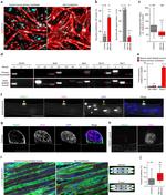 Myosin 4 Antibody in Immunocytochemistry (ICC/IF)