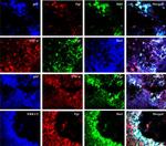 TNF alpha Antibody in Immunohistochemistry (IHC)