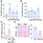 TNF alpha Antibody in Neutralization (Neu)