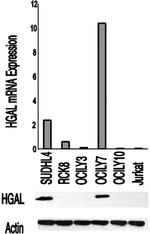 HGAL Antibody in Western Blot (WB)