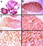 HGAL Antibody in Immunohistochemistry (IHC)