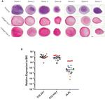 Collagen X Antibody in Immunohistochemistry (IHC)